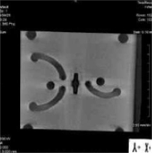 X-ray image.png X-ray image.png