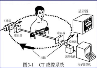 CT成像系统 CT成像系统