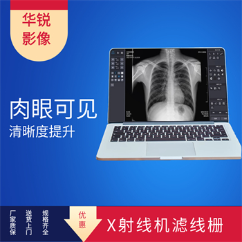滤线栅栅密度越大的优势-2