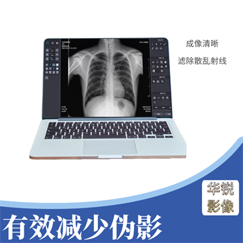 滤线栅比对图像的影响大不大-1