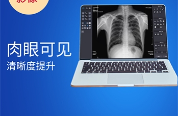 滤线栅尺寸评估 需要遵循什么