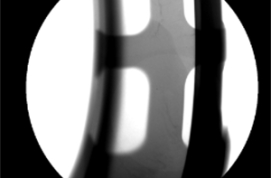 xray检测在工艺品检测中的关键应用是什么?