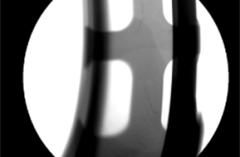 xray检测在工艺品检测中的关键应用是什么?