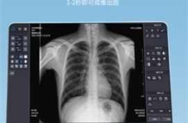 国产的哪些平板探测器性价比比较好