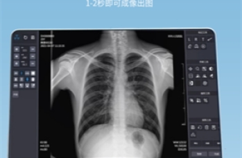 国产的哪些平板探测器性价比比较好