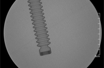 X-Ray检测与其他常规检查方法的区别