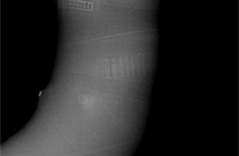 X-ray检测机的工作原理和应用领域有哪些？