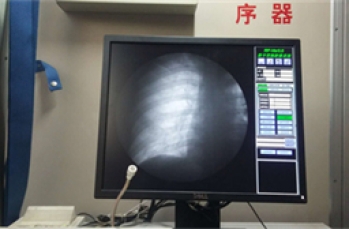 pcb线路板故障怎么用X-RAY检测？