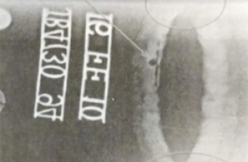 XRAY无损检测可以检测罐车罐体的焊缝缺陷吗？